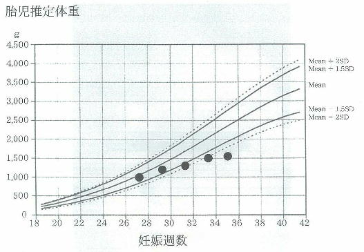 胎児機能不全 Non Reassuring Fetal Status Nrfs 医師国家試験対策wiki Atwiki アットウィキ