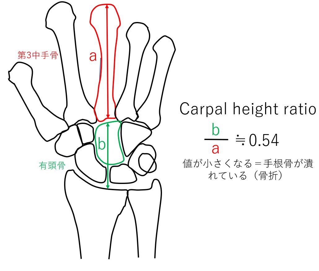 手関節正面撮影 一般撮影室 Atwiki アットウィキ